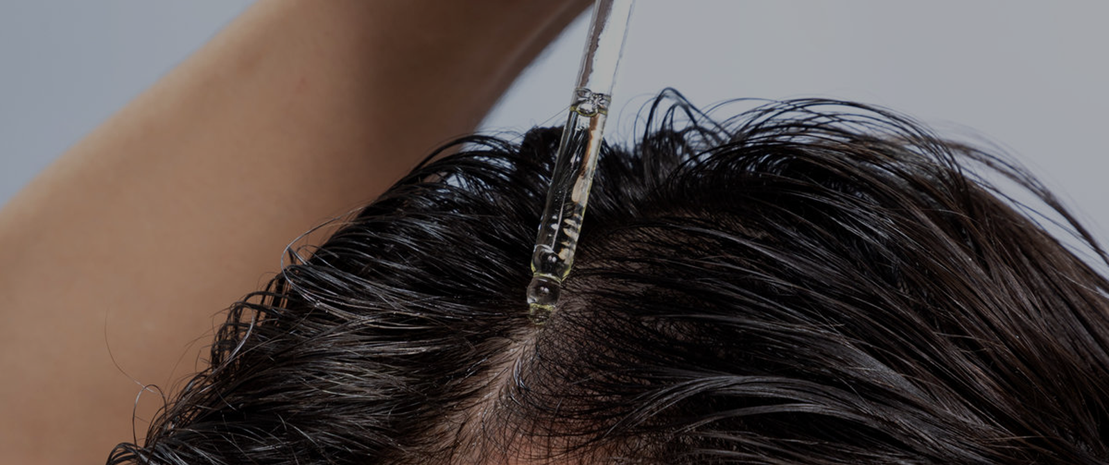 Hair Fall & Restoration Solutions in Andheri West