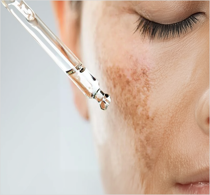Skin Treatment