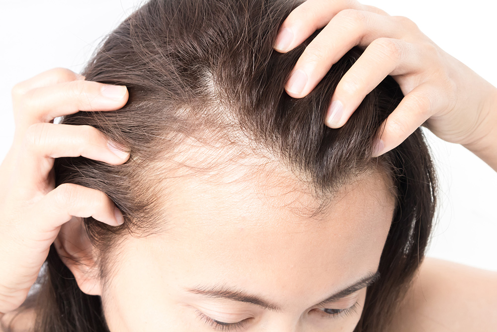 how to reduce hair fall